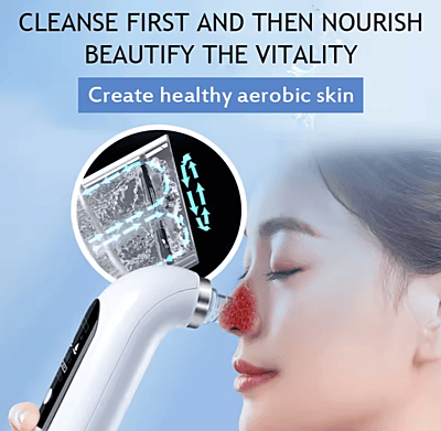 Blackhead Remover With Strong Vacuum Suction