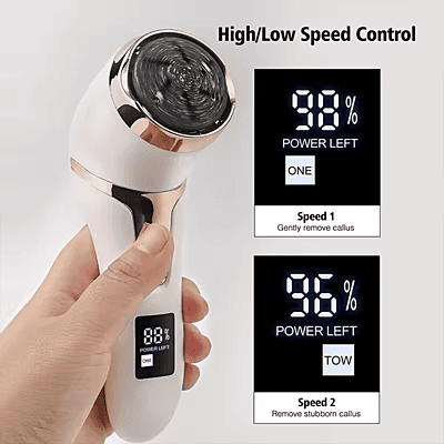 Electric Foot Callus Remover