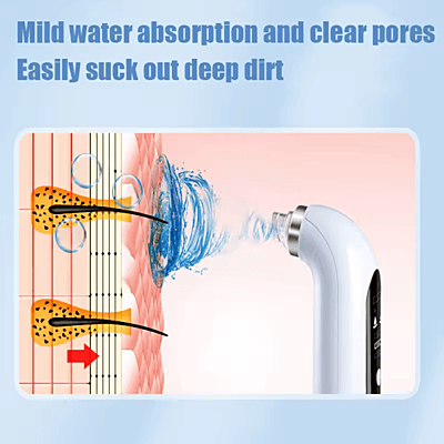 Blackhead Remover With Strong Vacuum Suction