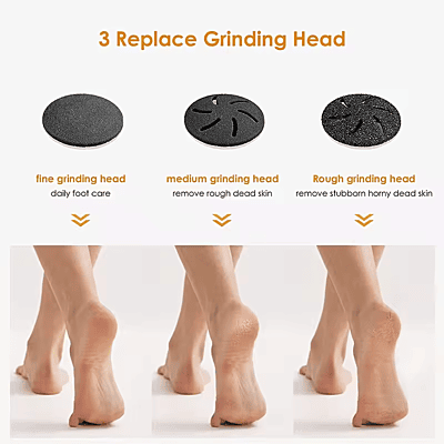 Electric Foot Callus Remover