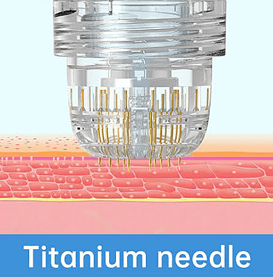 5 needle length: 0.25/0.5/0.6/1.0/1.5mm 5 needle length: 0.25/0.5/0.6/1.0/1.5mm