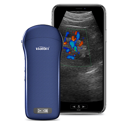 c10 3 in 1 probe portable ultrasound