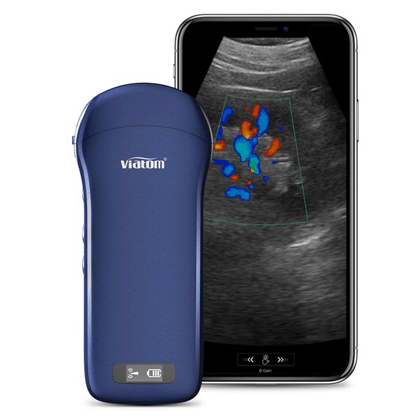 c10 3 in 1 probe portable ultrasound c10 3 in 1 probe portable ultrasound